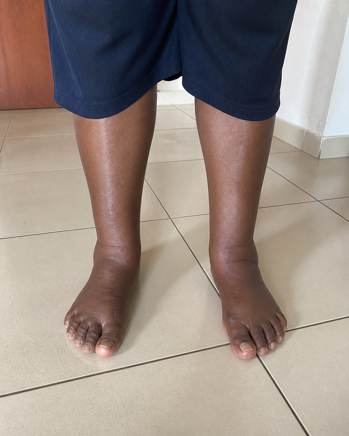 Grace's ankles and feet before beginning her daily wellness routine